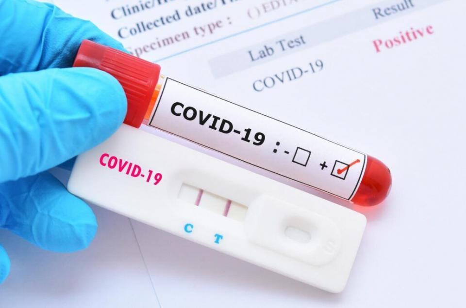 UK Government Announces Stop to COVID-19 Testing Requirements